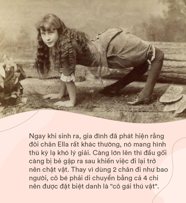 Vén màn bí ẩn đau buồn đằng sau cuộc đời Ella – cô gái khốn khổ bị coi như thú vật, phải đi bằng bốn chân và mua vui trong rạp xiếc đầu tiên trong lịch sử - Ảnh 2. Vén màn bí ẩn đau buồn đằng sau cuộc đời Ella – cô gái khốn khổ bị coi như thú vật, phải đi bằng bốn chân và mua vui trong rạp xiếc đầu tiên trong lịch sử - Ảnh 2.