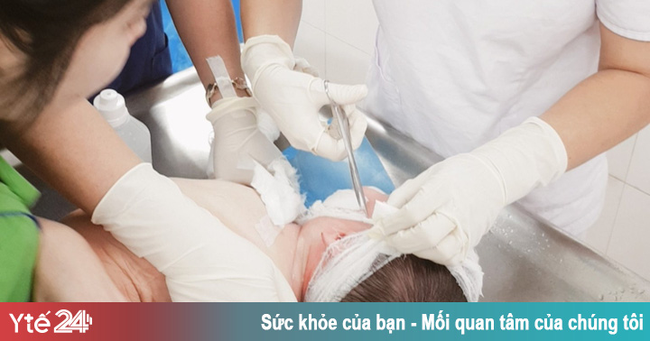 Liên tiếp trẻ nhập viện do bỏng nước sôi - Ảnh 1.