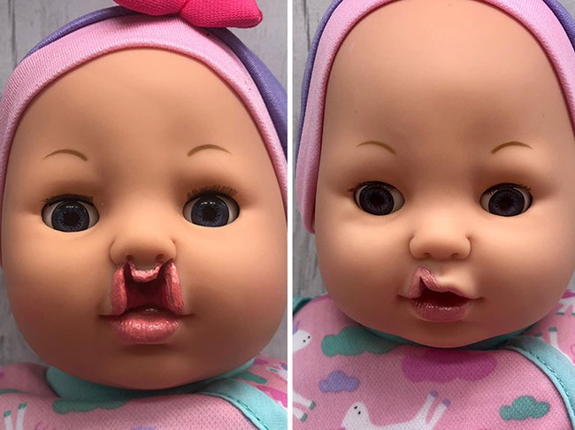 Con gái bị khiếm thính, bà mẹ đã làm một búp bê đặc biệt để tặng con, ai ngờ đây lại là cơ hội để chị "bén duyên" với một nghề được rất nhiều cha mẹ ủng hộ - Ảnh 9. Con gái bị khiếm thính, bà mẹ đã làm một búp bê đặc biệt để tặng con, ai ngờ đây lại là cơ hội để chị "bén duyên" với một nghề được rất nhiều cha mẹ ủng hộ - Ảnh 9.