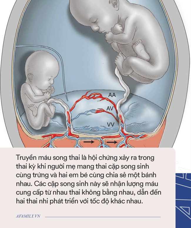 Lần đầu tiên gặp nhau sau 200 ngày xa cách, cặp chị em song sinh đã có hành động khiến nhiều người xúc động - Ảnh 2.