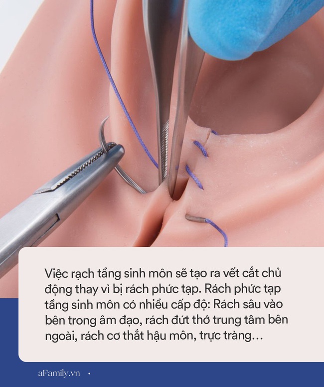 Bác sĩ Sản khoa nói về nỗi sợ hãi của nhiều chị em mang tên "Rạch tầng sinh môn", hóa ra nếu không rạch còn đáng sợ hơn nữa - Ảnh 4. Bác sĩ Sản khoa nói về nỗi sợ hãi của nhiều chị em mang tên "Rạch tầng sinh môn", hóa ra nếu không rạch còn đáng sợ hơn nữa - Ảnh 4.