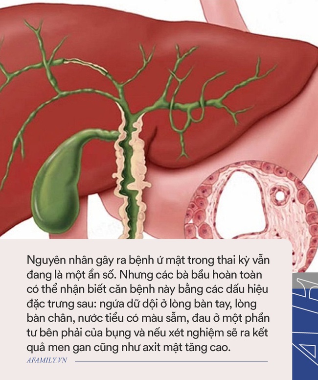 Càng về cuối thai kỳ càng bị ngứa, bà mẹ liền đi xét nghiệm, cầm kết quả trên tay bác sĩ đẩy ngay thai phụ vào phòng mổ khẩn cấp - Ảnh 3. Càng về cuối thai kỳ càng bị ngứa, bà mẹ liền đi xét nghiệm, cầm kết quả trên tay bác sĩ đẩy ngay thai phụ vào phòng mổ khẩn cấp - Ảnh 3.