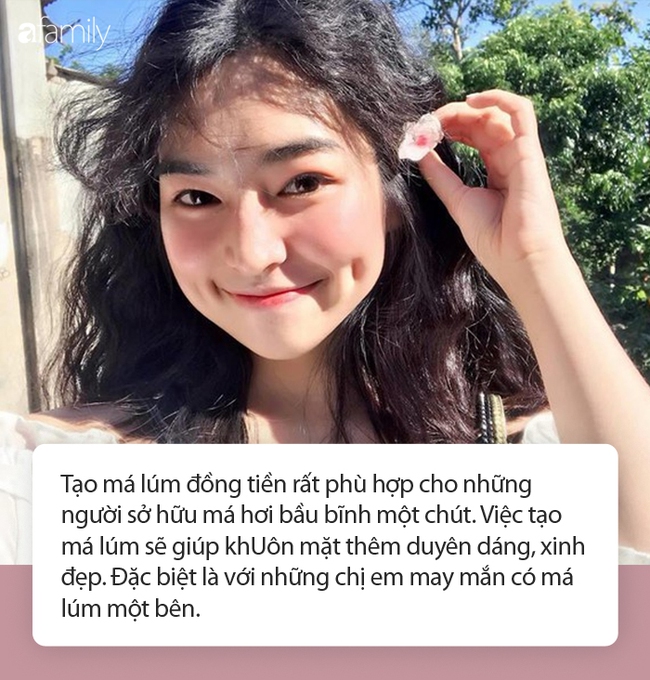 Làm má lúm đồng tiền cho thêm xinh thêm duyên: Chuyên gia chia sẻ từ A đến Z, đặc biệt lưu ý điều này trước khi làm - Ảnh 2. Làm má lúm đồng tiền cho thêm xinh thêm duyên: Chuyên gia chia sẻ từ A đến Z, đặc biệt lưu ý điều này trước khi làm - Ảnh 2.