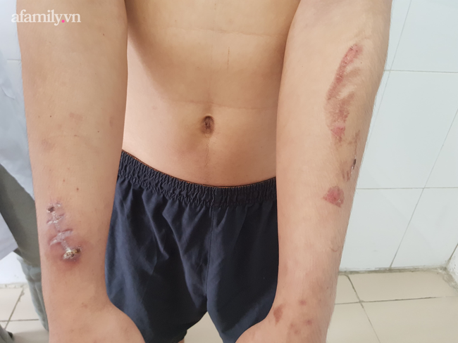 Những vết thương chưa thể xóa Những vết thương chưa thể xóa