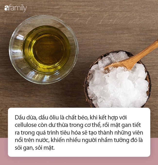 Xổ ra cả đống sỏi gan, sỏi mật nhờ uống dầu ôliu, dầu dừa: Sự thật kinh hoàng phía sau mới là điều bạn cần biết! - Ảnh 5.