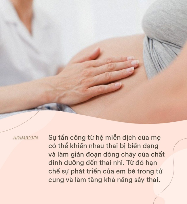 Mắc phải hội chứng lạ khiến hệ miễn dịch "tấn công" bào thai, cựu Hoa hậu Thế giới bị sảy thai đến 14 lần liên tiếp - Ảnh 3. Mắc phải hội chứng luôn xem bào thai là kẻ thù, một bà mẹ đã bị sảy thai 14 lần liên tiếp - Ảnh 3.