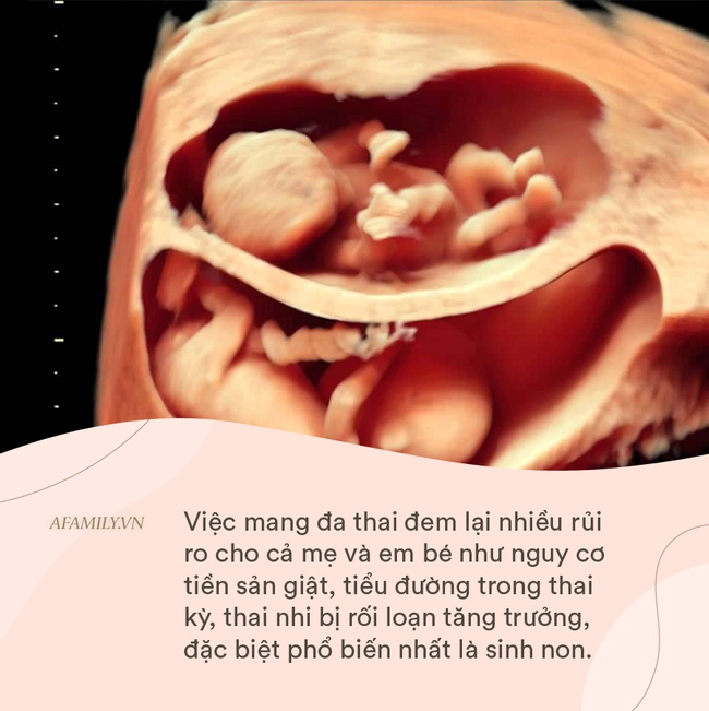 Kinh ngạc trước hình ảnh mô phỏng tư thế nằm của 2 cặp song sinh trong bụng mẹ - Ảnh 4.