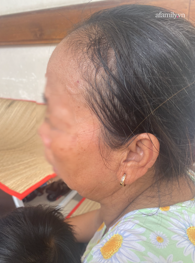 Lời kể bà ngoại bé gái 3 tuổi nguy kịch, nghi bị mẹ bạo hành: Để phân dính vào dép nên bị đánh? - Ảnh 9. Lời kể bà ngoại bé gái 3 tuổi nguy kịch, nghi bị mẹ bạo hành: Để phân dính vào dép nên bị đánh? - Ảnh 9.