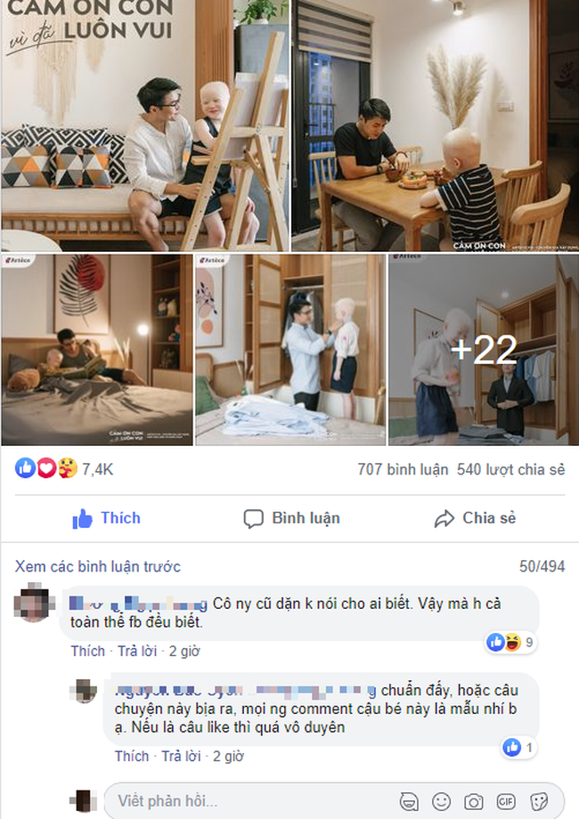 Sự thật bất ngờ đằng sau câu chuyện tình phụ tử gây sốt của ông bố đơn thân đẹp trai và cậu con trai mắc chứng bạch tạng, lấy bao nước mắt từ MXH - Ảnh 7. Sự thật bất ngờ đằng sau câu chuyện tình phụ tử gây sốt của ông bố đơn thân đẹp trai và cậu con trai mắc chứng bạch tạng, lấy bao nước mắt từ MXH - Ảnh 7.