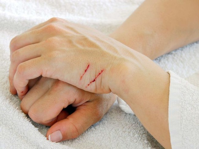 7 thói quen nhiều người làm tưởng chừng rất bình thường nhưng lại là "thủ phạm" âm thầm gây hại sức khỏe - Ảnh 1. 7 thói quen nhiều người làm tưởng chừng rất bình thường nhưng lại là "thủ phạm" âm thầm gây hại sức khỏe - Ảnh 1.