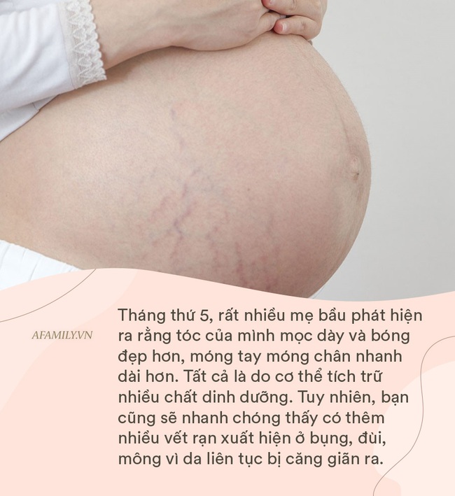 Không phải ai cũng cho bạn biết những &quot;tác dụng phụ&quot; mà mẹ bầu nào cũng phải trải qua trong hơn 9 tháng mang thai - Ảnh 2.