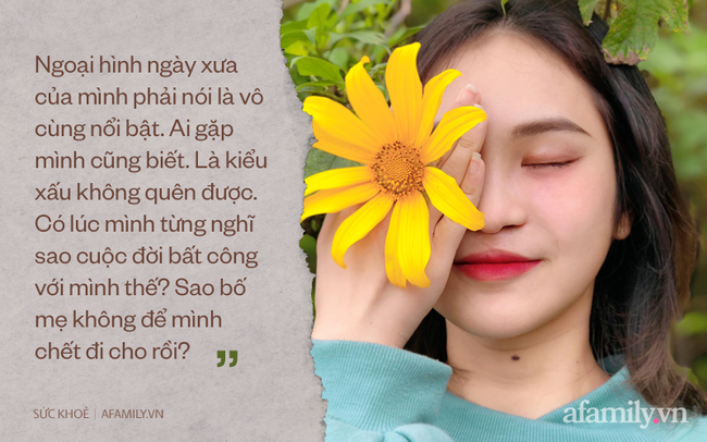Từng nghĩ đến cái chết vì dị tật sứt môi, hở hàm ếch, nữ sinh Phú Thọ mạnh mẽ trải qua 6 lần dao kéo và có màn lột xác vô cùng đỉnh cao - Ảnh 5. Từng nghĩ đến cái chết vì dị tật sứt môi, hở hàm ếch, nữ sinh Phú Thọ mạnh mẽ trải qua 6 lần dao kéo và có màn lột xác vô cùng đỉnh cao - Ảnh 5.