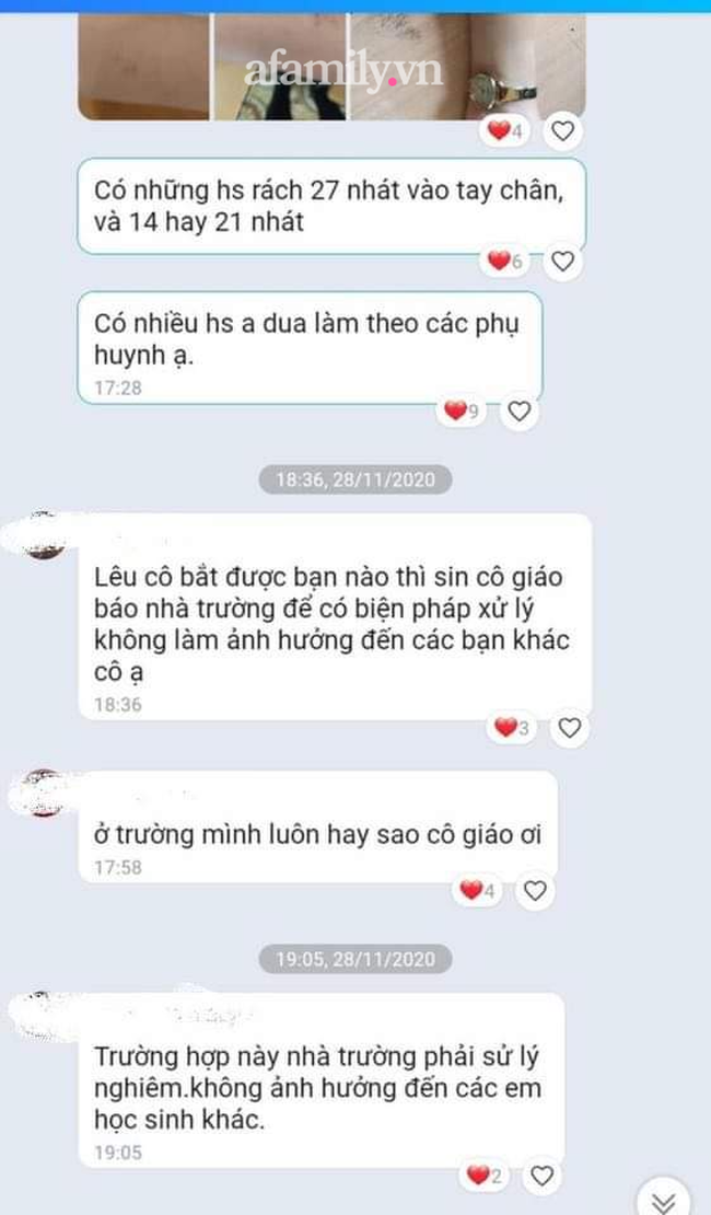 Cảnh báo: Xôn xao học sinh lớp 6 tự rạch tay chân, nghi học theo video trên Youtube - Ảnh 3. Cảnh báo: Xôn xao học sinh lớp 6 tự rạch tay chân, nghi học theo video trên Youtube - Ảnh 3.