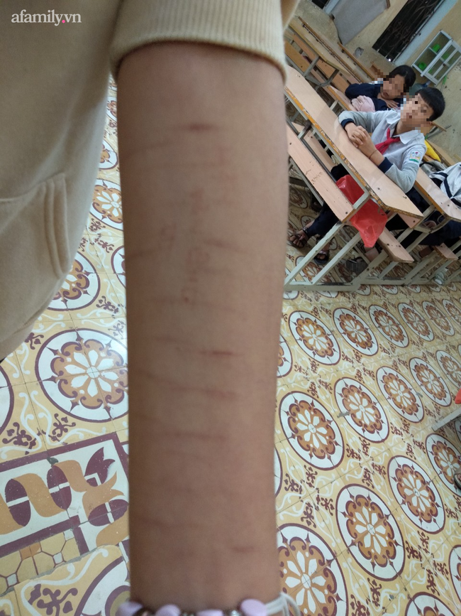 Cảnh báo: Xôn xao học sinh trung học tự rạch tay chân, nghi học theo video trên Youtube - Ảnh 1. Cảnh báo: Xôn xao học sinh trung học tự rạch tay chân, nghi học theo video trên Youtube - Ảnh 1.