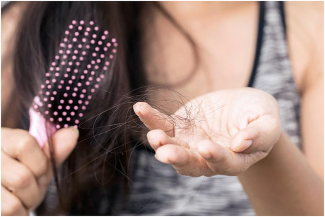 Không chỉ rụng tóc đến hói đầu, các triệu chứng sau cũng là dấu hiệu cho thấy cơ thể đang bị thiếu hụt quá nhiều nhóm vitamin B - Ảnh 5.