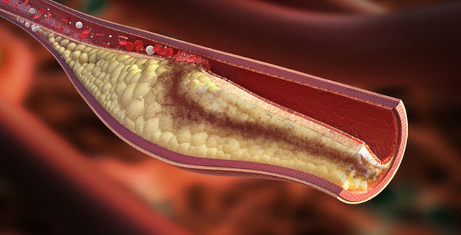 Đang cholesterol cao nhưng lại thèm ăn thì đừng quên 8 món ăn vặt này, vừa rẻ bèo lại còn giàu dinh dưỡng - Ảnh 1.