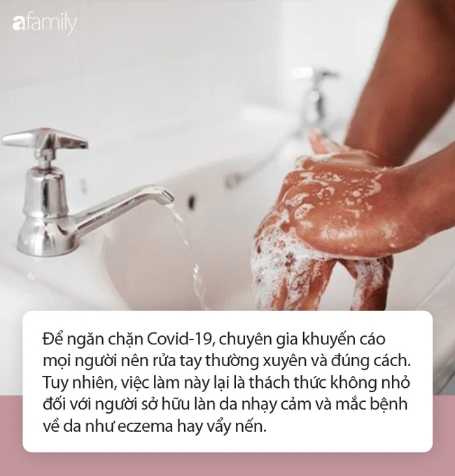 Chuyên gia chỉ cách rửa tay hiệu quả đối với người mắc bệnh về da, có làn da nhạy cảm - Ảnh 3.