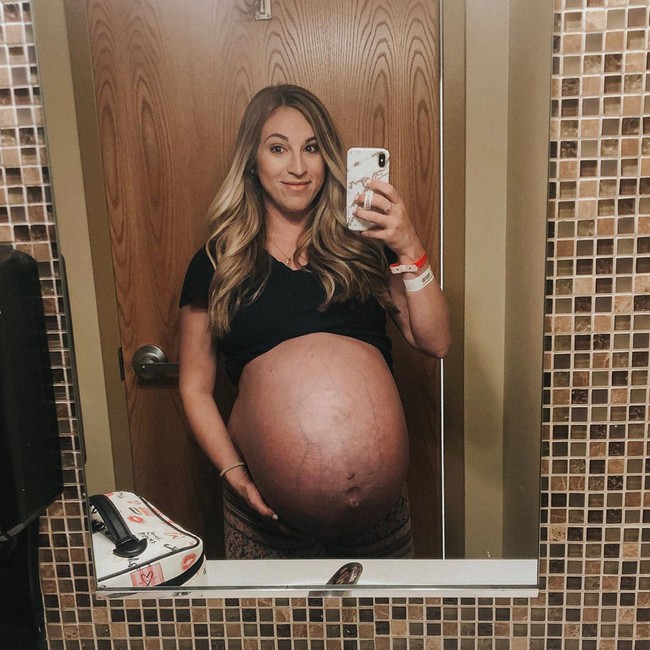 Hình ảnh bụng bầu mang thai đôi, thai ba là minh chứng cho thấy mẹ đã mạnh mẽ như thế nào, khiến nhiều ai nhìn thôi cũng thấy xót xa - Ảnh 10.