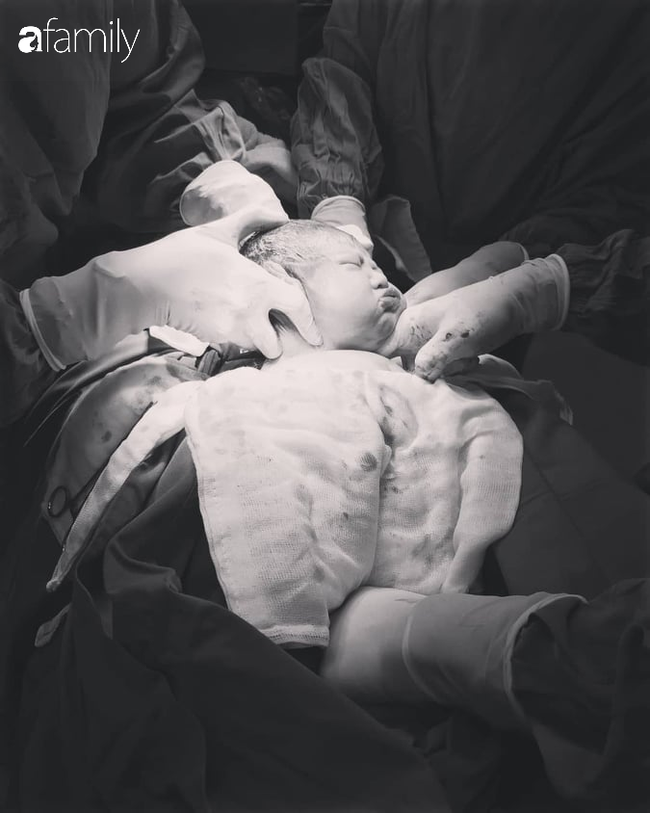 Cận cảnh khoảnh khắc em bé chui ra khỏi bụng mẹ được cô y tá chụp giúp mẹ Đà Lạt, người mẹ nào xem cũng thấy xúc động - Ảnh 1.