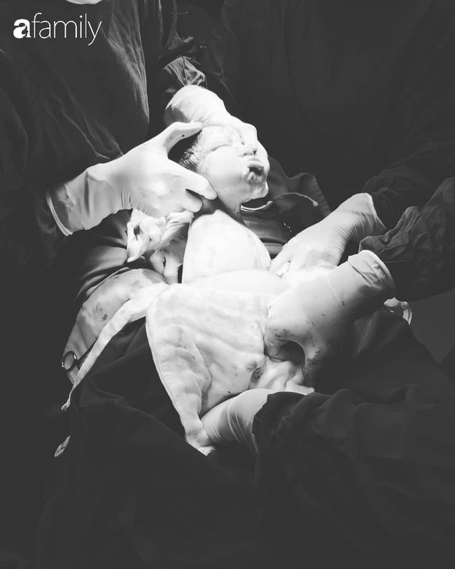 Cận cảnh khoảnh khắc em bé chui ra khỏi bụng mẹ được cô y tá chụp giúp mẹ Đà Lạt, người mẹ nào xem cũng thấy xúc động - Ảnh 2.