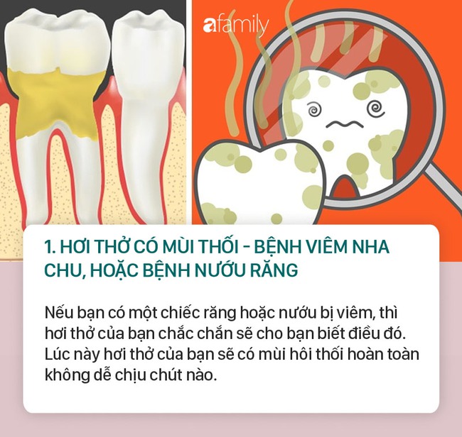 Người bị bệnh gan, thận, ung thư phổi, ung thư dạ dày, bệnh tiểu đường... thì hơi thở thường có mùi như thế này - Ảnh 1.