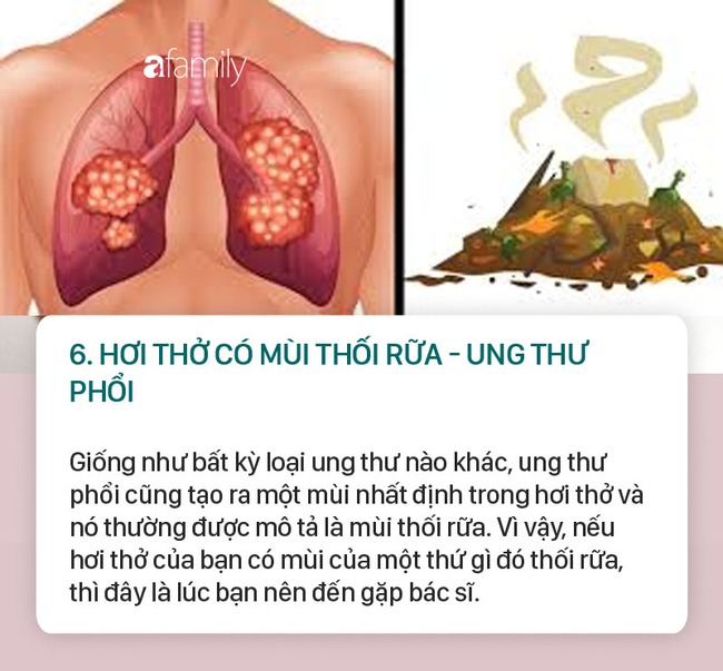 Người bị bệnh gan, thận, ung thư phổi, ung thư dạ dày, bệnh tiểu đường... thì hơi thở thường có mùi như thế này - Ảnh 6.