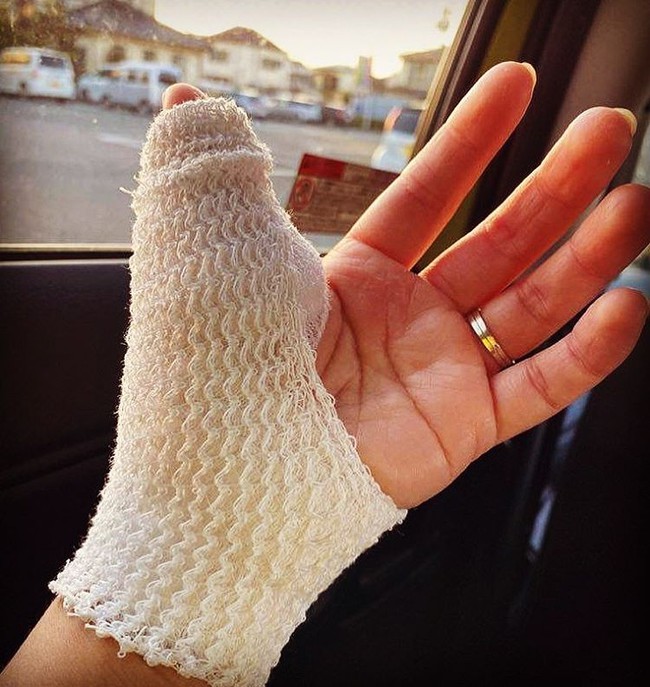 Dân mạng “thót tim” khi thấy bàn tay băng bó trắng xóa của Quỳnh Trần JP, nguyên nhân được hé lộ là tai nạn nghề nghiệp khá nghiêm trọng - Ảnh 2.