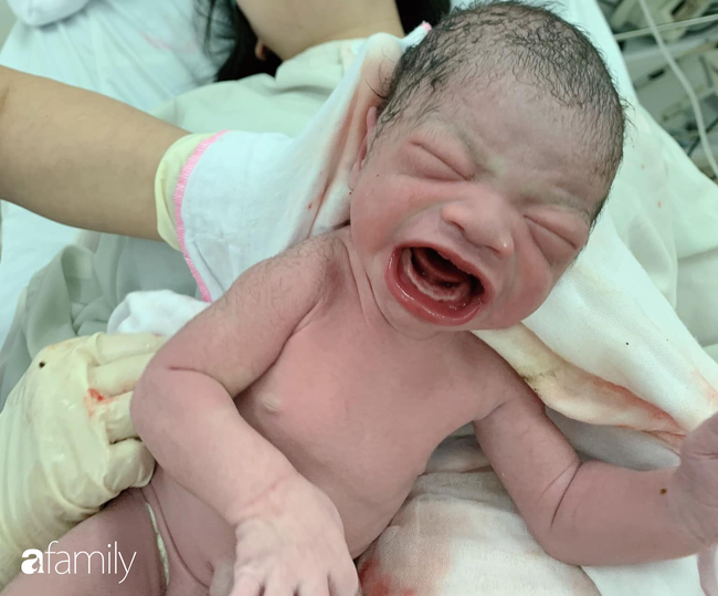 Bức ảnh khóc chào đời ấn tượng của em bé Lào Cai: Mở miệng rộng hết cỡ để gào cho đã khiến bác sĩ cũng phải giật mình - Ảnh 1.
