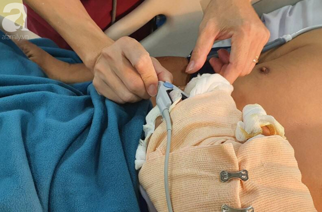 Vụ người đ&agrave;n &ocirc;ng bị d&ugrave;ng m&atilde; tấu ch&eacute;m đứt l&igrave;a cẳng tay kinh ho&agrave;ng ở TP.HCM: Nạn nh&acirc;n n&oacute;i g&igrave;? - Ảnh 2.