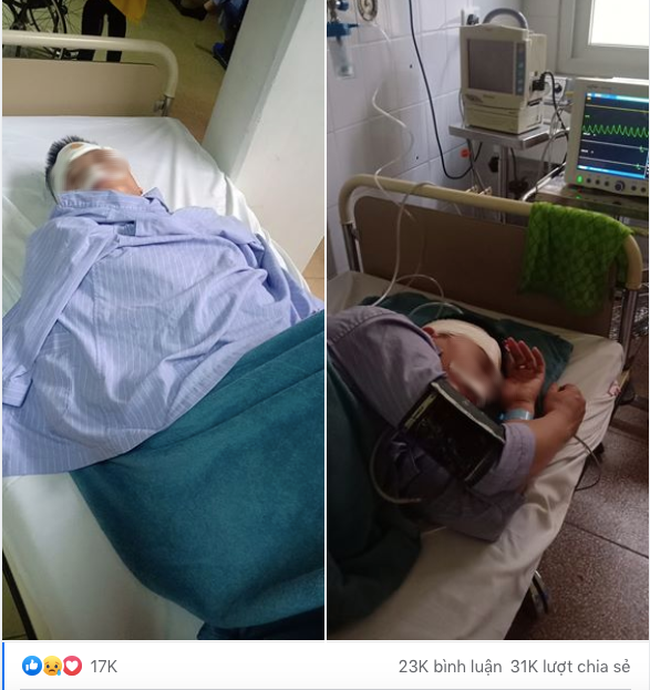 Câu chuyện của người vợ có chồng tai nạn chấn thương sọ não vì đi nhậu với bạn khiến tất cả bàng hoàng - Ảnh 2. Câu chuyện của người vợ có chồng tai nạn chấn thương sọ não vì đi nhậu với bạn khiến tất cả bàng hoàng - Ảnh 2.