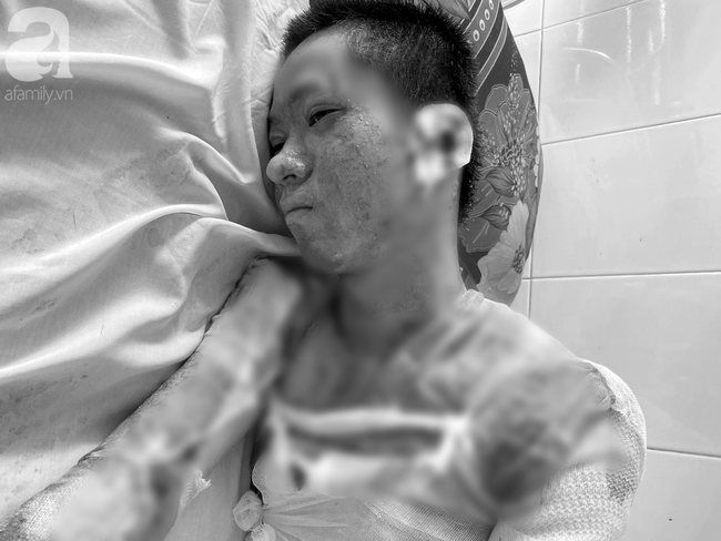 Thương tâm: Nhà bị cột cửa phóng hỏa giữa đêm nghi do mâu thuẫn tình cảm, mẹ tử vong còn con trai bỏng nặng - Ảnh 1. Thương tâm: Nhà bị cột cửa phóng hỏa giữa đêm nghi do mâu thuẫn tình cảm, mẹ tử vong còn con trai bỏng nặng - Ảnh 1.
