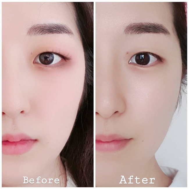 Dầu tẩy trang giúp làm sạch sâu nhưng nếu mắc 4 lỗi sau, bạn sẽ nhận lấy cái kết ngược lại: Lỗ chân lông bít tắc, da đầy mụn ẩn - Ảnh 4. Dầu tẩy trang giúp làm sạch sâu nhưng nếu mắc 4 lỗi sau, bạn sẽ nhận lấy cái kết ngược lại: Lỗ chân lông bít tắc, da đầy mụn ẩn - Ảnh 4.