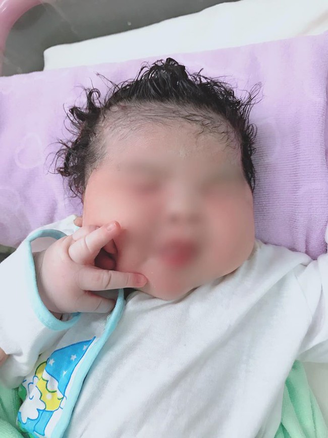 Hiếm gặp: Sản phụ Sóc Trăng mang thai lần 7 hạ sinh em bé nặng 6,1kg  - Ảnh 3.