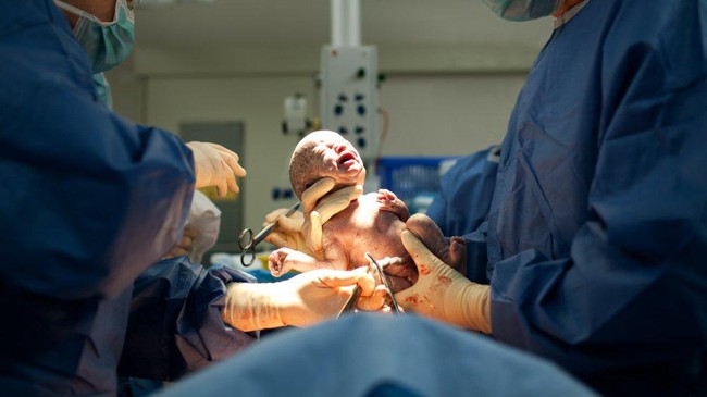 Muốn h&igrave;nh dung một c&aacute;ch đơn giản v&agrave; dễ hiểu nhất về quy tr&igrave;nh sinh mổ, h&atilde;y xem ngay đoạn video g&acirc;y b&atilde;o mạng n&agrave;y - Ảnh 1.