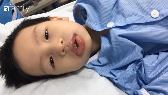Từng nghĩ răng sữa sâu không sao, rồi sẽ thay, mẹ Hà Nội đã hối hận khi con trai phải gây mê để điều trị răng sâu - Ảnh 6.