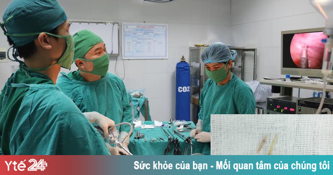 Trẻ đau bụng nhập viện, gia đình tá hỏa khi bác sĩ gắp ra tăm, xương trong dạ dày - Ảnh 1.