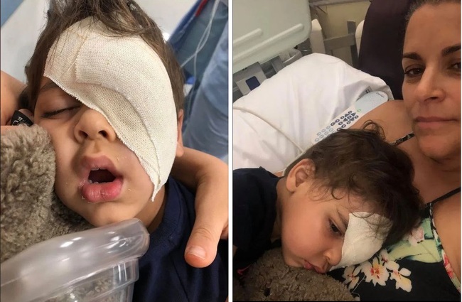 Chụp hình thấy mắt con có một viên bi nhưng vẫn chủ quan không cho con đi khám, bà mẹ chết lặng nghe tin sét đánh khi bệnh viện yêu cầu đưa bé trai đến hóa trị gấp - Ảnh 3.