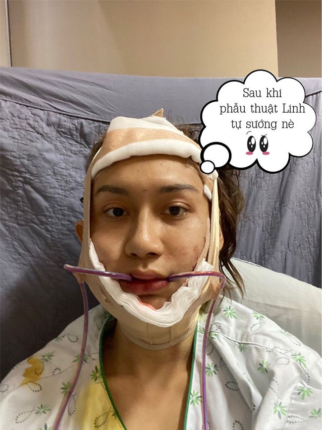 Lynk Lee khoe cận cảnh gương mặt biến chuyển qua từng giai đoạn hậu chuyển giới, nhìn lúc mới phẫu thuật xong mà xót xa - Ảnh 3. Lynk Lee khoe cận cảnh gương mặt biến chuyển qua từng giai đoạn hậu chuyển giới, nhìn lúc mới phẫu thuật xong mà xót xa - Ảnh 3.