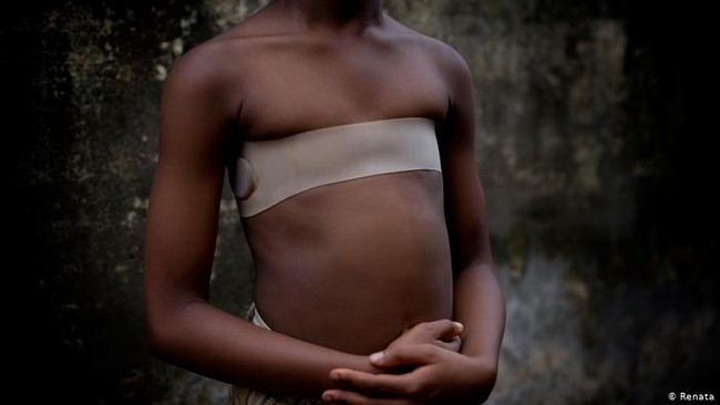 Tập tục khủng khiếp để &quot;bảo vệ&quot; những bé gái ở châu Phi tránh bị quấy rối tình dục: Là phẳng ngực từ khi mới dậy thì bằng đá, thìa nung nóng - Ảnh 1.