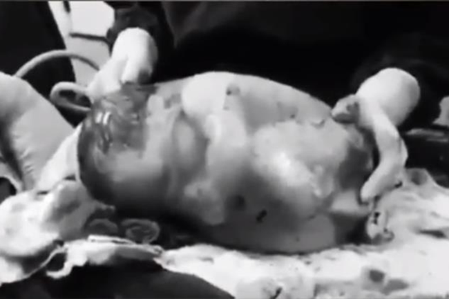 Bé gái chào đời nằm nguyên trong túi ối, 80.000 ca sinh mới gặp một lần - Ảnh 1.