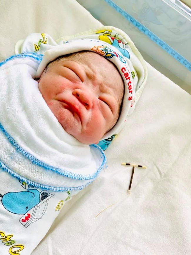 Bé sơ sinh chào đời ở một bệnh viện sản ở Hải Phòng gây sốt với chiếc vòng tránh thai trong tay - Ảnh 3.