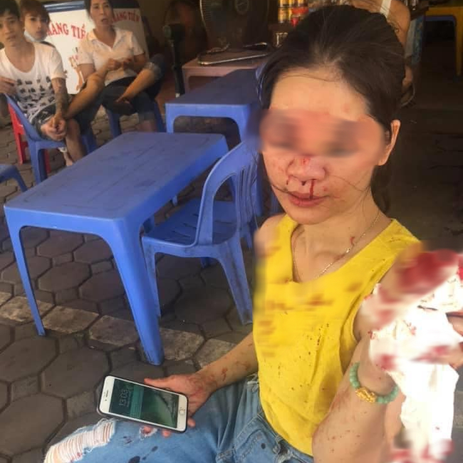 Hà Nội: Đi tìm sự thật thông tin nữ khách hàng bị thẩm mỹ viện Venus "gọi giang hồ" đánh chảy máu mặt vì đòi "bảo hành" - Ảnh 1. Hà Nội: Đi tìm sự thật thông tin nữ khách hàng bị thẩm mỹ viện Venus "gọi giang hồ" đánh chảy máu mặt vì đòi "bảo hành" - Ảnh 1.