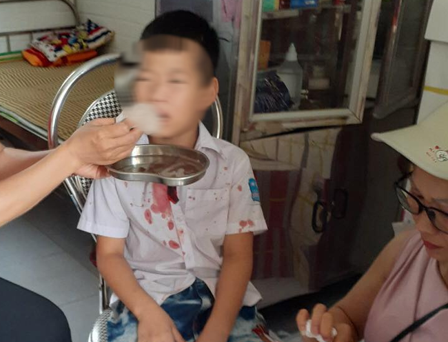 Vụ học sinh lớp 1 bị hành hung: Gia đình yêu cầu làm rõ việc có hay không bé trai bị người đàn ông lôi từ trong trường ra ngoài để đánh - Ảnh 6.