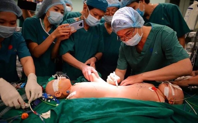 Xúc động từng khoảnh khắc trong ca phẫu thuật tách rời hai bé dính nhau: Cuộc đại phẫu cân não của 5 ê-kíp bác sĩ - Ảnh 12.