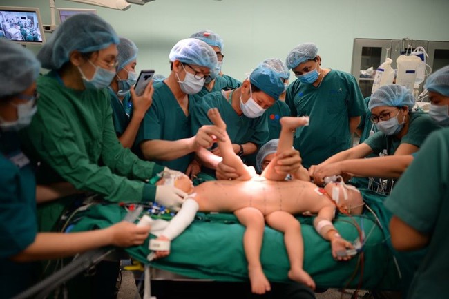 Xúc động từng khoảnh khắc trong ca phẫu thuật tách rời hai bé dính nhau: Cuộc đại phẫu cân não của 5 ê-kíp bác sĩ - Ảnh 13.