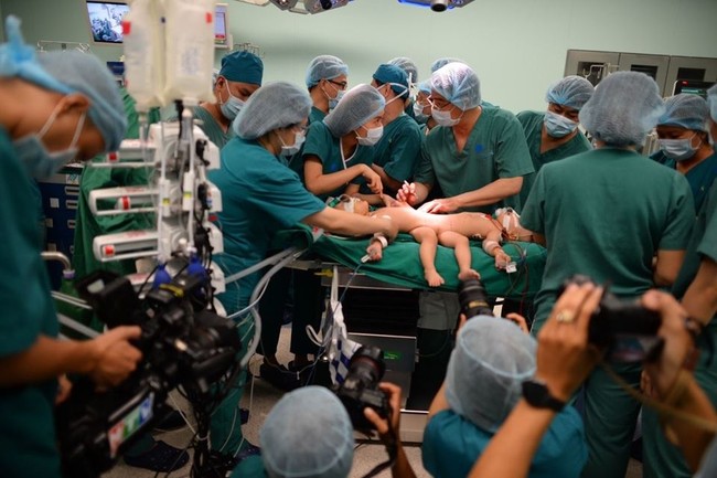 Xúc động từng khoảnh khắc trong ca phẫu thuật tách rời hai bé dính nhau: Cuộc đại phẫu cân não của 5 ê-kíp bác sĩ - Ảnh 11.