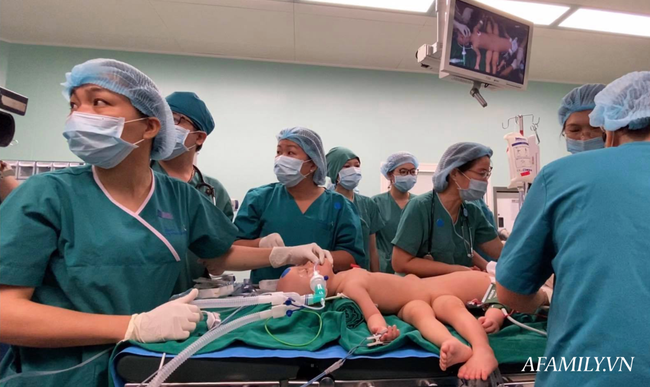 Xúc động từng khoảnh khắc ca phẫu thuật tách rời hai bé dính nhau: Nhừng đường rạch da cân não từ 5 ekip bác sĩ - Ảnh 4.