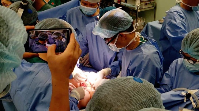GS.BS Trần Đông A, cố vấn ca phẫu thuật tách rời hai bé song sinh chia sẻ về tình hình hiện tại của các bé - Ảnh 3.