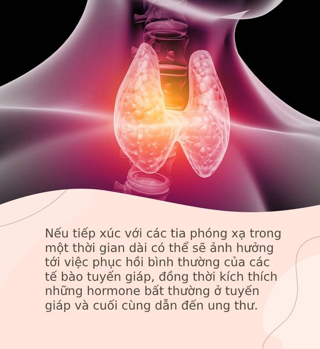 4 nguồn gây bệnh cực kỳ phổ biến nhưng nếu không tránh xa ngay từ bây giờ rất có thể sẽ dính "án tử" của ung thư tuyến giáp - Ảnh 2. 4 nguồn gây bệnh cực kỳ phổ biến nhưng nếu không tránh xa ngay từ bây giờ rất có thể sẽ dính "án tử" của ung thư tuyến giáp - Ảnh 2.