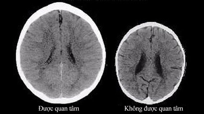 Vừa trông con vừa xem điện thoại cũng gây ra những tác hại nghiêm trọng đối với sự phát triển của trẻ, nhất là não bộ - Ảnh 1.